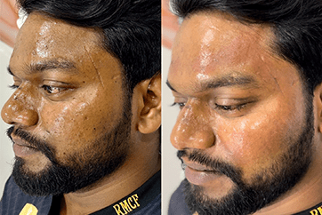 before-after-portrait